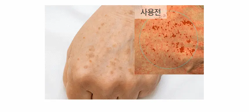 [아이돌선세럼/24시간지속] 아로셀 멜라 TXA 선세럼 40ml 상세페이지 32